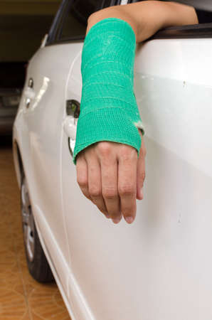 arm broken with green cast, insurance conceptの写真素材