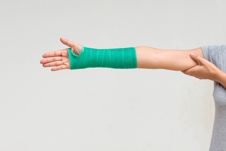 Injury woman wearing sports ware with green cast on hand and arm, body injury concept.の写真素材