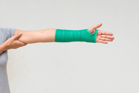 Injury woman wearing sports ware with green cast on hand and arm, body injury concept.の写真素材