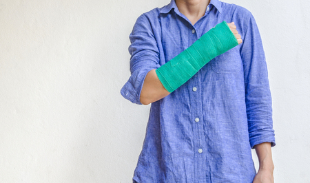 worker woman accident on arm with green cast.の写真素材