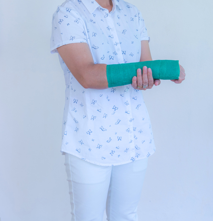 injured woman with green cast on arm standing and holding broken arm.の写真素材