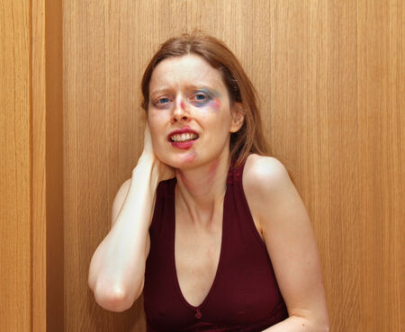 Scared young woman abused at home with visible bruises on faceの写真素材