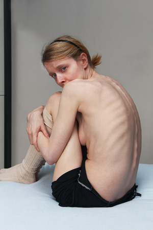 Young skinny anorexic girl seating curled up on a bed with bones on her back protrudingの写真素材