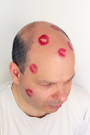 Bald man with lipstick kiss marks on his headの写真素材