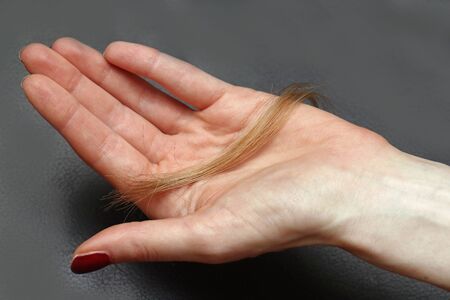 Female lost blonde hair chunk in hand palmの写真素材