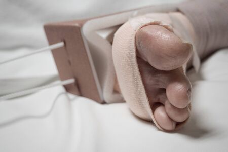 Left foot of the patient on clean bed in the hospital.の写真素材