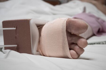 Left foot of the patient on clean bed in the hospital.の写真素材