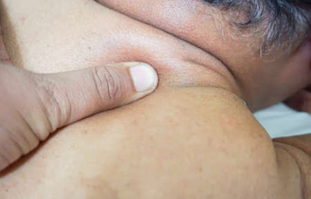 Senior man receiving a back massage. Low light and selective focusの写真素材