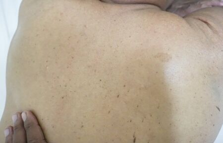 Senior man receiving a back massage. Low light and selective focusの写真素材