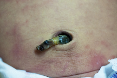 new born baby navelのeditorial素材