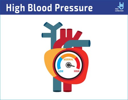 Arterial high blood pressure checking concept vector illustration flat icon cartoon design.のイラスト素材
