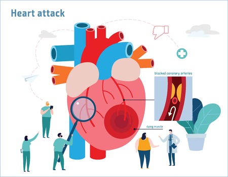 Heart Attack Infographic Atherosclerosis Medical Banner Healthcare