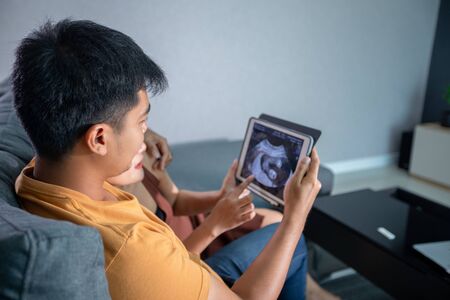 Asian Beautiful pregnant woman and husband looking ultrasound scan on a couch in the living room at home. Concept of Pregnancy health care.の写真素材