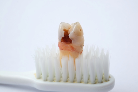 teeth Caries on white background