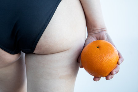 Cellulite or orange skin effect. Woman holding orange by her legsの写真素材
