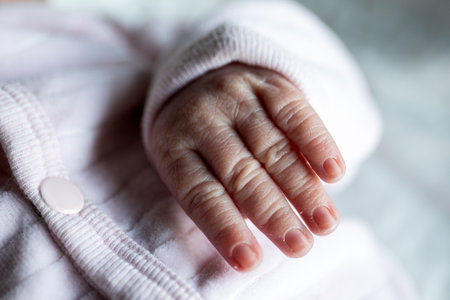 Newborns hand. fingers, nails and peeling dry skinの写真素材