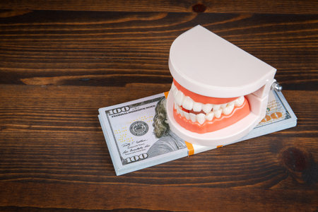 Banknotes in a pile, a model of teeth on top on wooden background. Dental costs conceptの写真素材