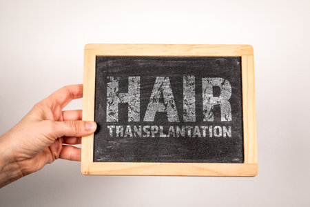 Hair Transplantation. Text on a miniature chalkboard backgroundの写真素材