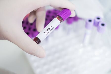 Asian male doctor holding Covid-19 Blood Sample on White Background