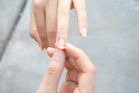 Image of a broken nail handの写真素材