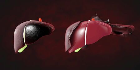 Human infection liver and renewed. Medical science illustration.