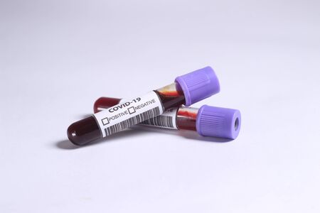 Close Up Photo, Simple Conceptual, Glass Blood Covid-19 Test tube, without result