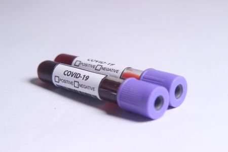 Close Up Photo, Simple Conceptual, Glass Blood Covid-19 Test tube, without result