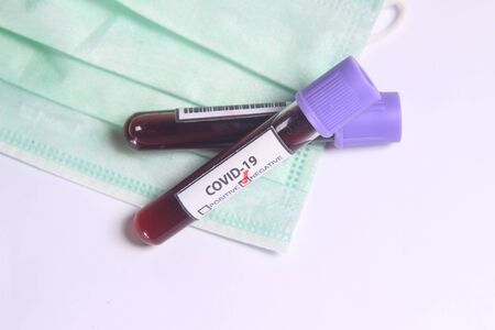 Close Up Photo, Simple Conceptual, Glass Blood Covid-19 Test tube above N95 Surgical Maskの写真素材