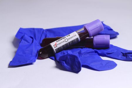 Close Up Photo, Simple Conceptual, Glass Blood Covid-19 Test tube, positive result, above Blue Rubber Gloveの写真素材