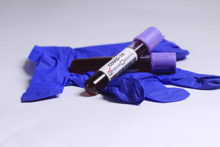 Close Up Photo, Simple Conceptual, Glass Blood Covid-19 Test tube, positive result, above Blue Rubber Gloveの写真素材