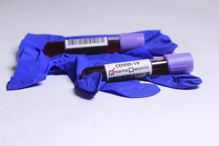 Close Up Photo, Simple Conceptual, Glass Blood Covid-19 Test tube, positive result, above Blue Rubber Gloveの写真素材