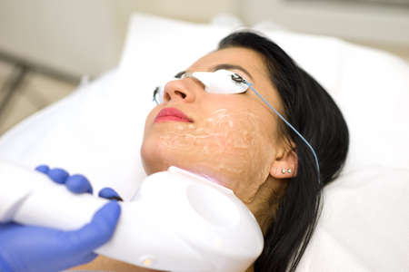 Beautiful young woman lying on a table with protect glasses on eyes getting a laser skin treatmentの写真素材