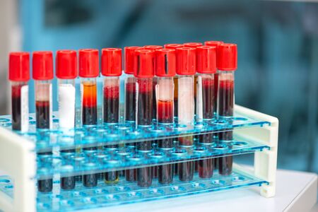 Tubes of blood sample for testingの写真素材