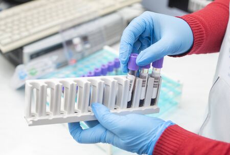 doctor hand taking a blood sample tube from a rack with machines of analysis in the lab background /...