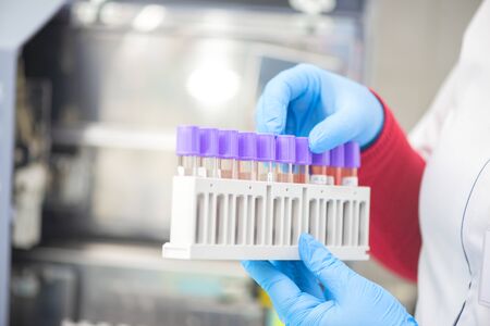 doctor hand taking a blood sample tube from a rack with machines of analysis in the lab background /...