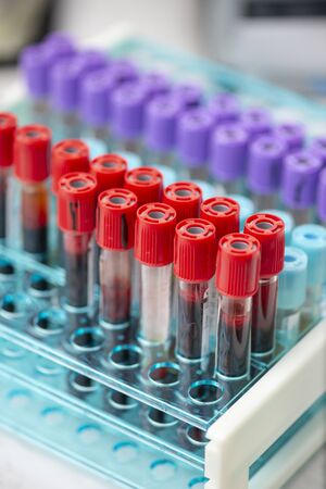 Tubes of blood sample for testingの写真素材