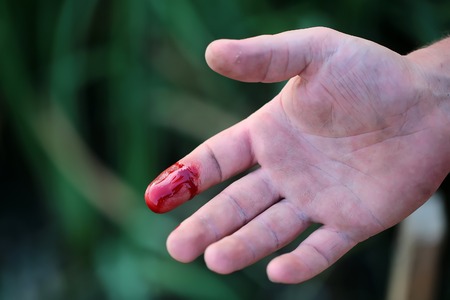 Closeup view of index finger on right human hand turned with palm is cut hurt and bleeding with bright red blood outdoor sunny day on blured green background, horizontal pictureの写真素材