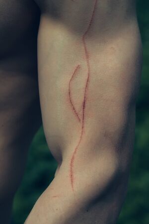 Male muscular hand with fresh abrasion red colorの写真素材