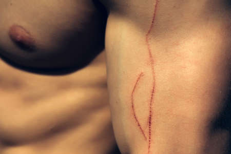 Male bare chest and torso of muscular body with fresh abrasion on hand sunny dayの写真素材