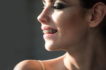 Girl or woman with braces on teeth smile. Dental care concept. Stomatology, orthodontics, health, beauty.の写真素材
