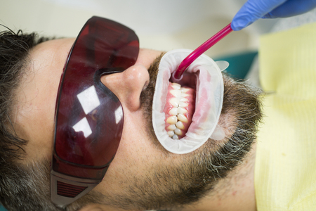 Dentist examining patients teeth in clinic. Teeth whitening.の写真素材
