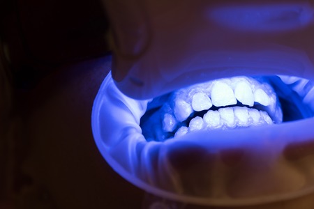 Close-up of a female patient at dentist in the clinic. Young blond female opening her mouth while...