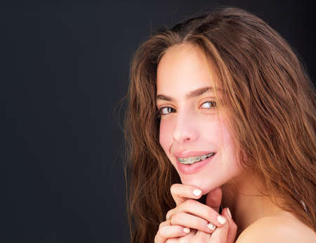 Orthodontics and dentistry. Smiling girl with braces. Teeth alignment.