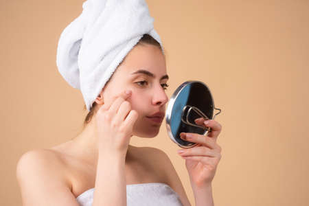 Acne blemish spots skin on woman. Skin of beauty young girl, looking in mirror. Spot scar acne, freckles, and melasma pigmentation skin facial treatment on face woman. Problem skin.の写真素材