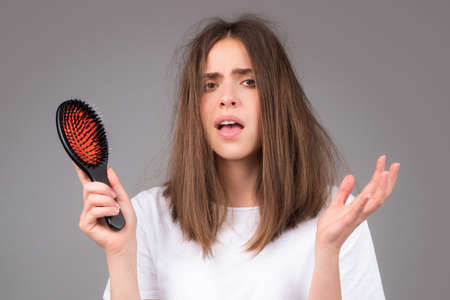 Woman loosing hair. Hair loss problem, baldness.の写真素材