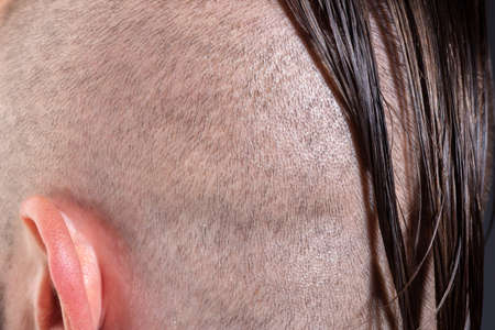 Short hair texture background closeup. Hairstylist bold head. Barbershop concept. Man barber hairstylist.の写真素材