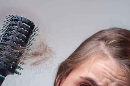 Concept of hair loss. Hair loss close up. tangled Problem hair.の写真素材
