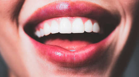 Smile teeth. Laughing woman mouth with great teeth close up. Healthy white teeth. Closeup of smile with white healthy teeth.の写真素材