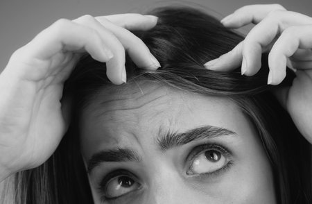 Woman with hair loss problem. Portrait of Young girl with a bald. Head shot of a nervous girl with a hairbrush.の写真素材