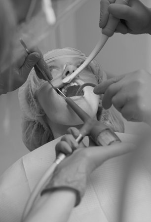 Close-up portrait of a female patient at dentist in the clinic. Close-up portrait of a female patient visiting dentist for teeth whitening in clinic.の写真素材